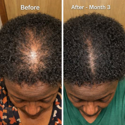 HAIR+ Follicle Reactivation Supplement