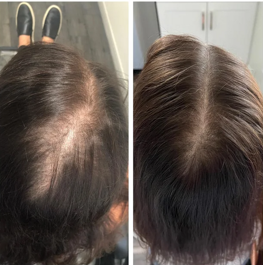 HAIR+ Follicle Reactivation Supplement